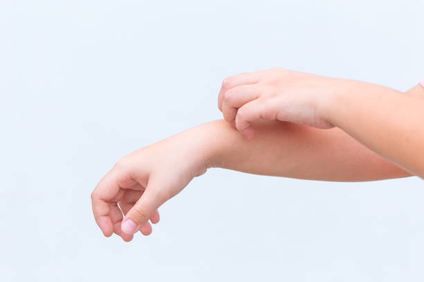 istock Skin Itching with Hand Scratching on white background 874686744