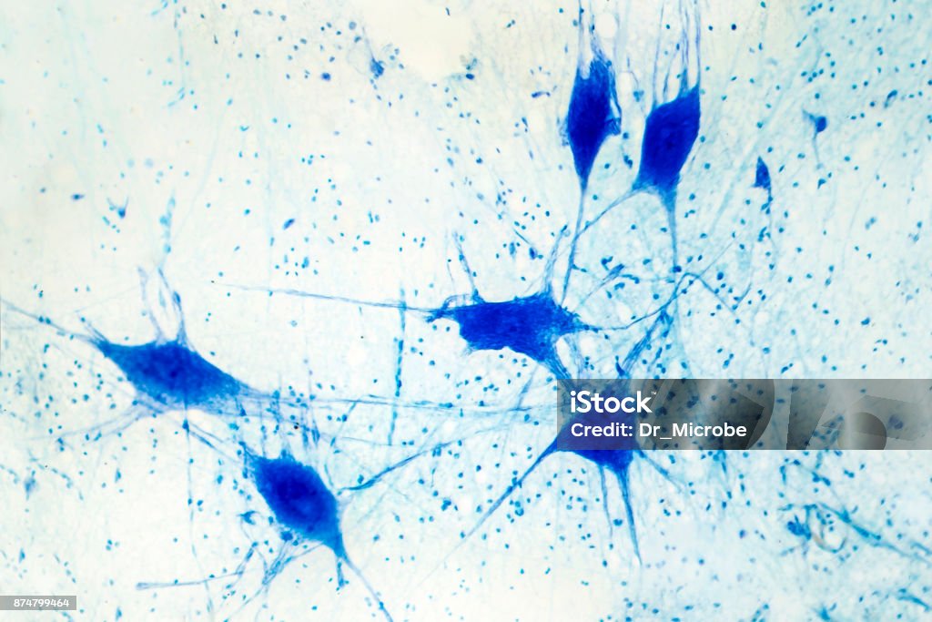 Micrografía de luz de tejido de cerebro humano - Foto de stock de Célula nerviosa libre de derechos