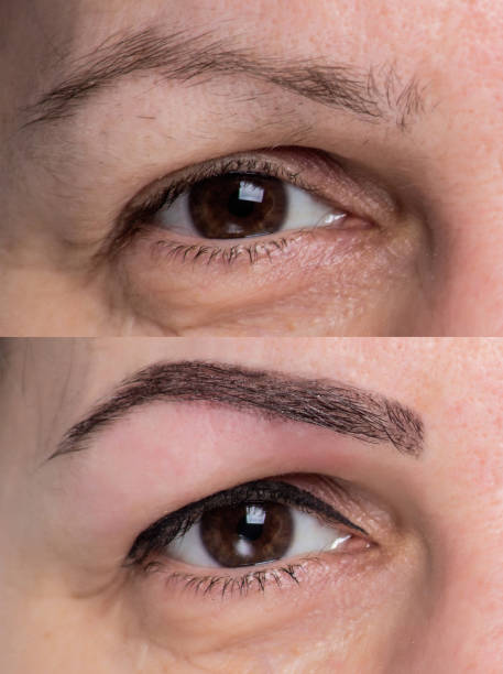 istock woman beauty face skin beautiful 875654514