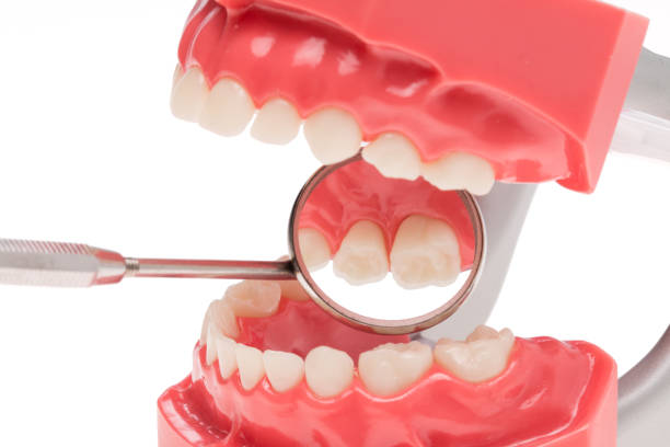prótesis dental, salud dental, higiene dental - medizinisch fotografías e imágenes de stock