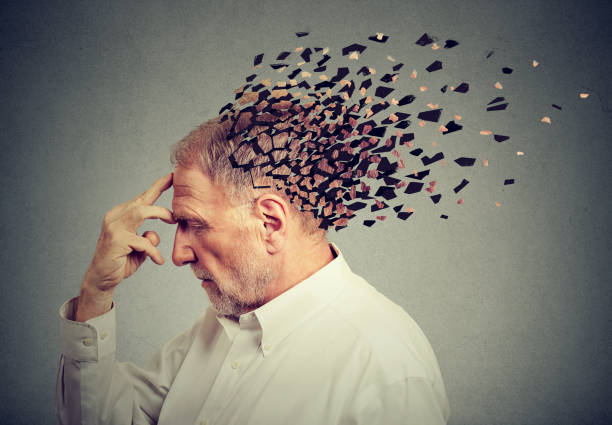Memory loss due to dementia. Senior man losing parts of head  as symbol of decreased mind function. stock photo