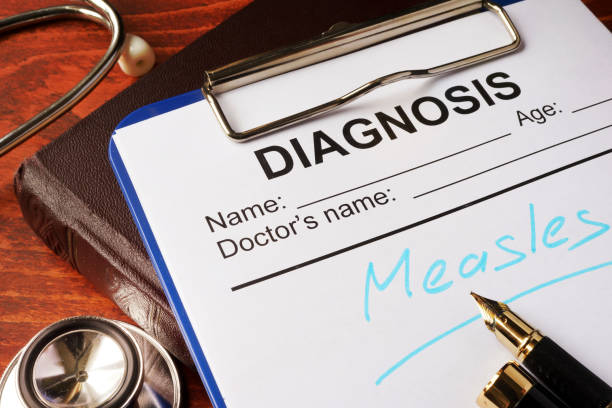 istock Medical form with diagnosis Measles on a table. 876071228