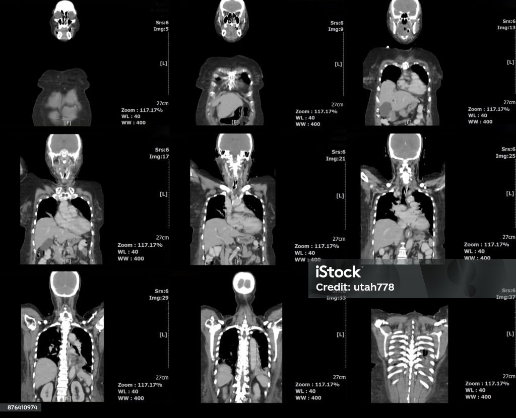 analyse médicale - Photo de Échographie libre de droits