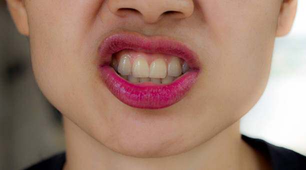 istock Beautiful lips, Asian beauty 876487250