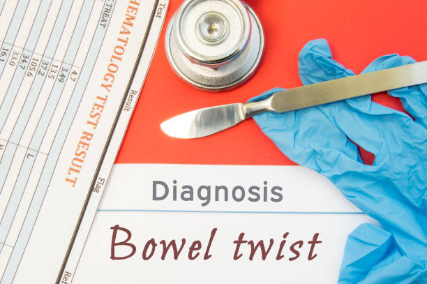 diagnosi chirurgica della torsione intestinale. bisturi dello strumento medico chirurgico, guanti di lattice, analisi dell'esame del sangue si trovano vicino accanto alla diagnosi dell'iscrizione testuale di bowel twist. concetto di malattie chirurgiche - scalpel blood paper surgery foto e immagini stock