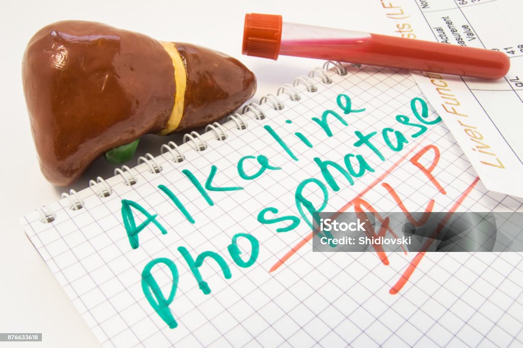 간 수치 혈액 간 기능 테스트 결과 함께 테스트 튜브는 비문 알칼리 성 인산 가수분해 효소 Alp 근처입니다 생화학 그것의 레벨 ...