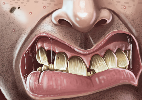 Snarly Teeth Snarling Man With Bad Teeth Stock Illustration - Download Image Now ...