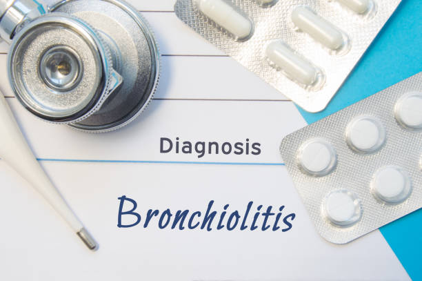 diagnosis bronchiolitis. doctor's stethoscope, electronic thermometer and two blisters of pills lying near pad with inscription of diagnosis bronchiolitis. concept of report in internal medicine - bronquiolite imagens e fotografias de stock