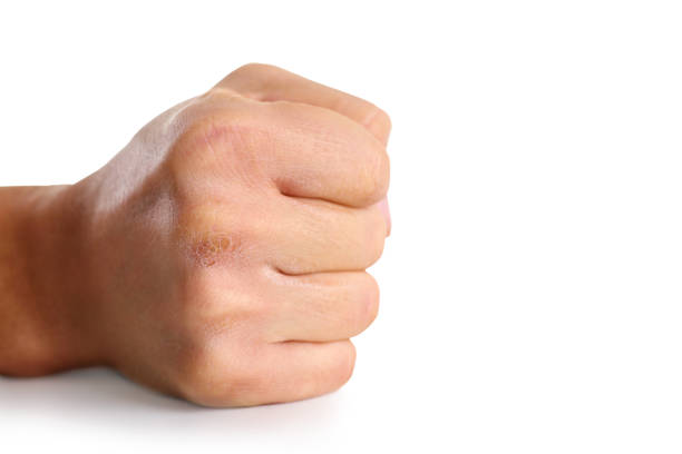 Raised clenched fist in the air, symbol of protest, resistance, strength, and solidarity, close-up with blurred city background,concept of empowerment, activism, unity and social or political movement