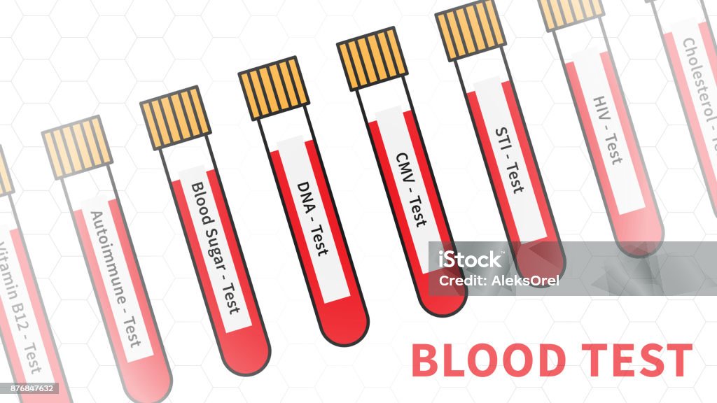 Sample Testing Vector Blood Test Samples Vector Illustration Stock Illustration - Download ...