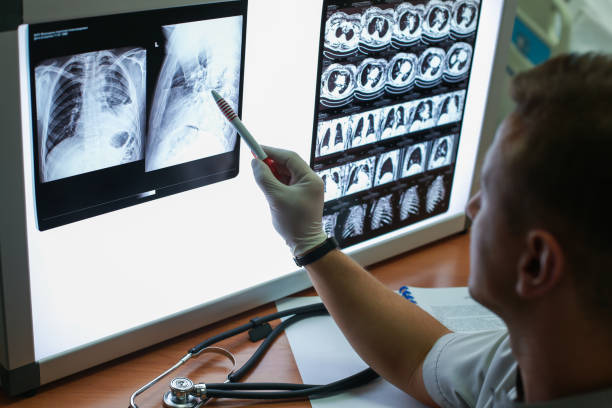 radiografia - human lung asthmatic x ray human internal organ foto e immagini stock