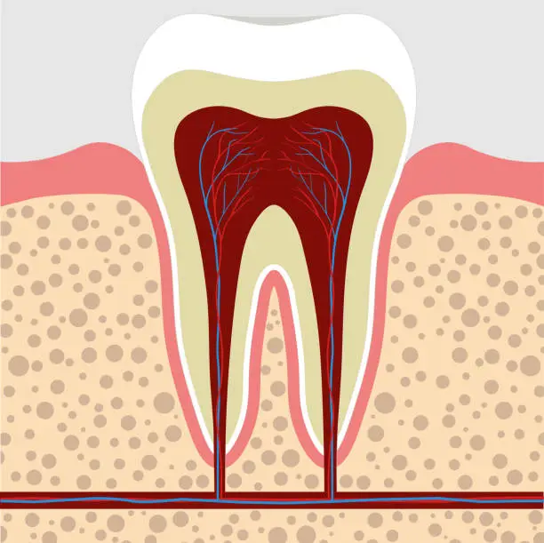 Vector illustration of tooth, gum in a cross section. Tooth Root cana