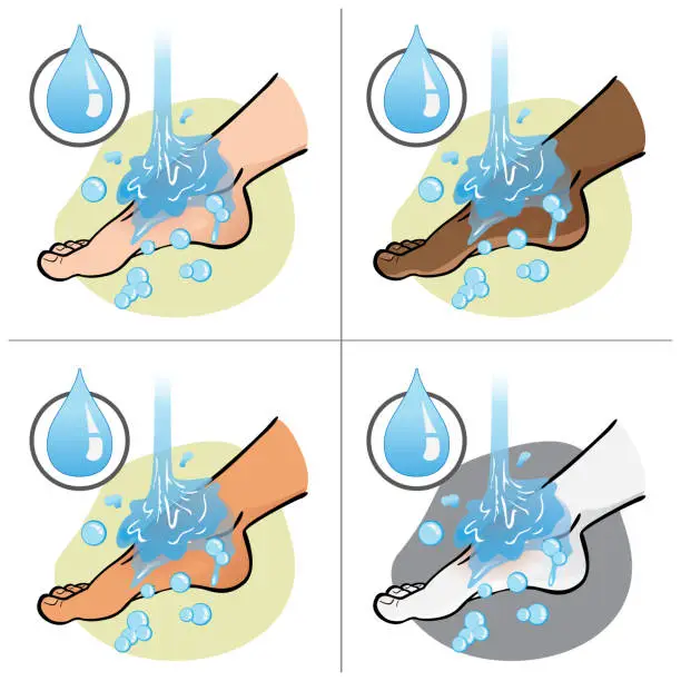 Vector illustration of Illustration of first aid person, ethnic, foot side view, rinsing or washing with water, foot with an injury. Ideal for catalogs, information and medicine guides