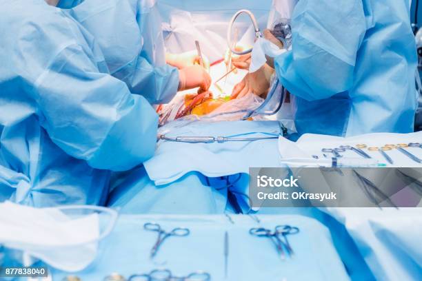 クローズ アップ現代クリニックで腹腔鏡装置を使用して手術 - 泌尿器系のストックフォトや画像を多数ご用意 - 泌尿器系, 胃, 腹腔鏡下手術