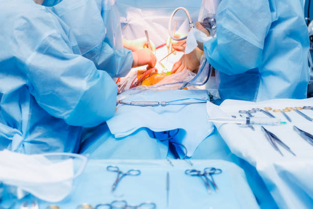fechar a operação cirúrgica, usando equipamento laparoscópico na clínica moderna - abdómen - fotografias e filmes do acervo