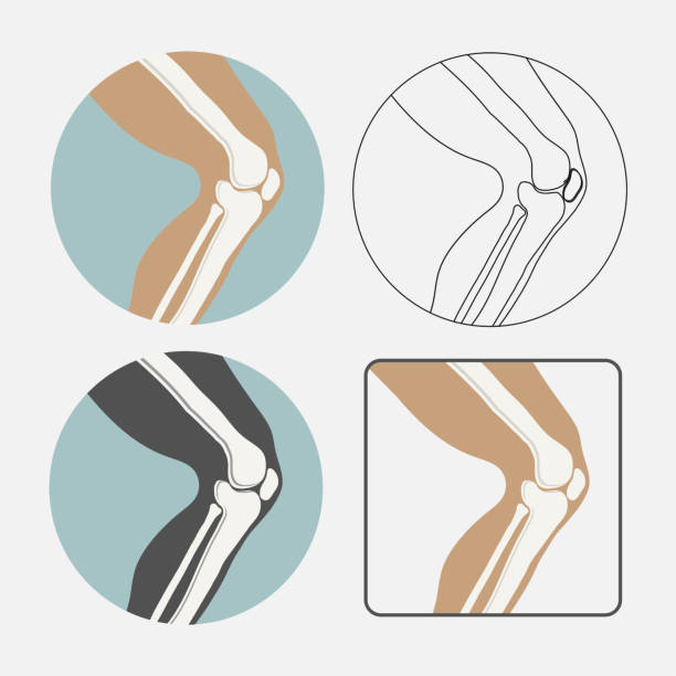 인간의 무릎 관절 아이콘 설정, 정형 외과 클리닉, 평면 styl 로고 - x ray human knee orthopedic equipment human bone stock illustrations