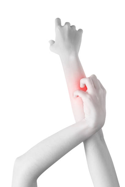 istock Scratching her arm in a woman isolated on white background. Clipping path on white background. 878170502