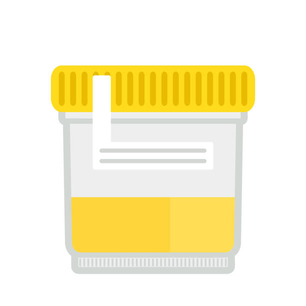 Urine test in a plastic jar. vector art illustration