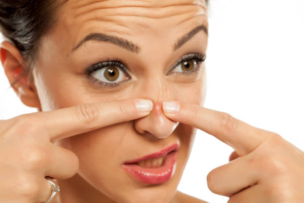 istock a young woman squeezes the pimple on her nose 878981136