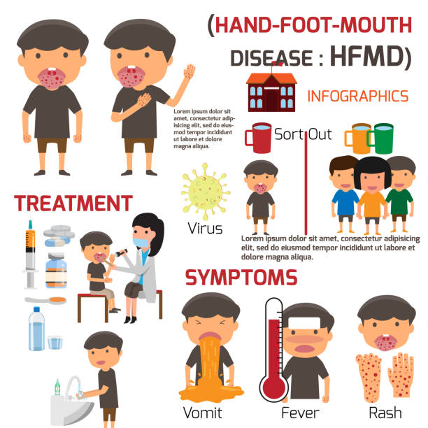 HFMD children infected. Poster detail of Hand-foot-mouth disease Infographics with symptoms prevention and treatment. cartoon health concept vector illustration. vector art illustration