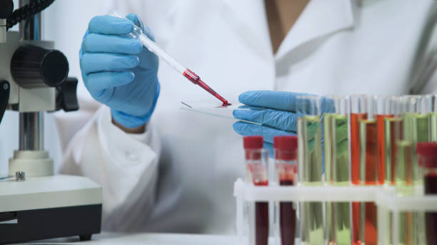 recherche biochimique du sang, assistant de laboratoire analyse microbiologique - test du sida photos et images de collection