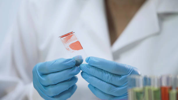 medico che analizza campioni microbiologici, campione di sangue, test hiv - bacteriologist foto e immagini stock