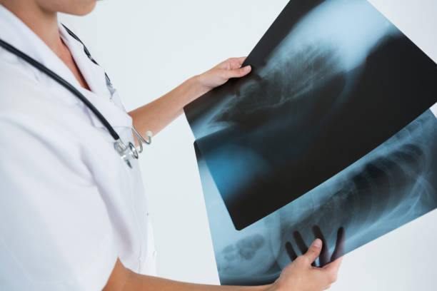 istock Mid section of female doctor examining X-rays 879770058