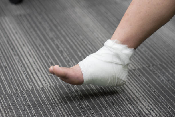 istock Injured ankle Painful with bandage 880147368