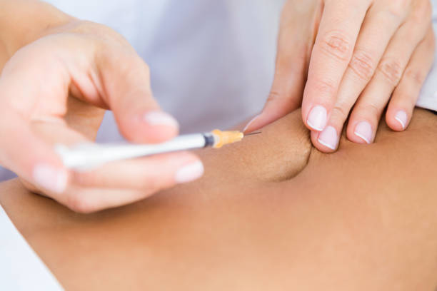istock Surgeon making injection into female body. Liposuction concept. 880547210