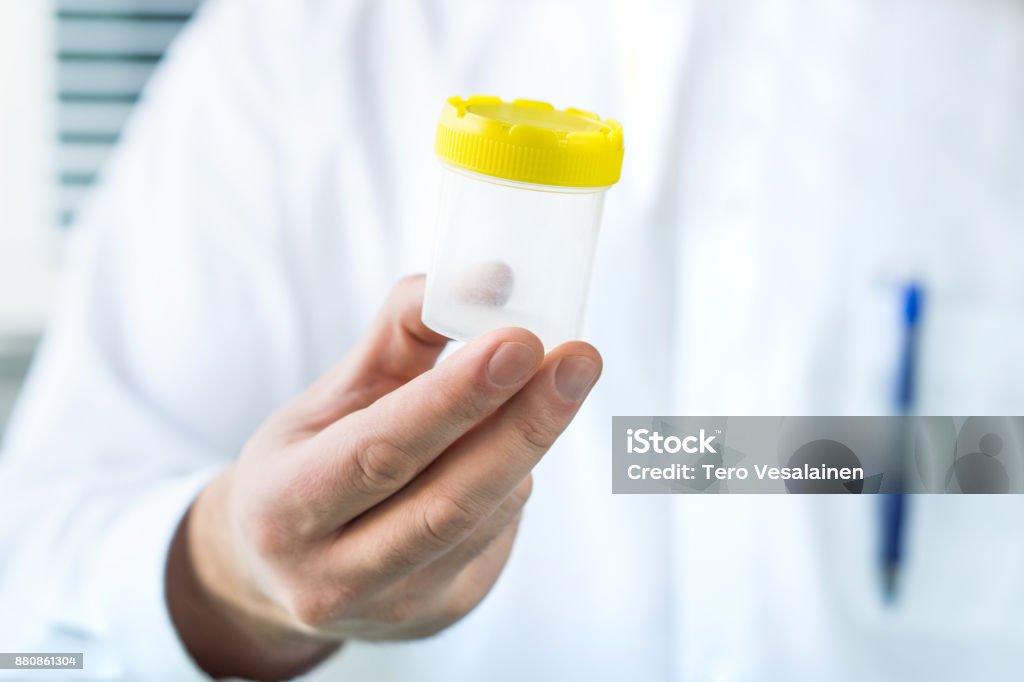 Doctor holding urine sample cup. Doctor holding urine sample cup. Medical test in hospital. Sperm Stock Photo