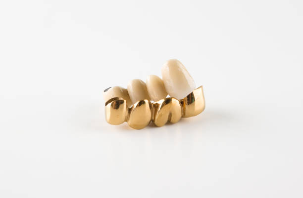 istock Artificial teeth made of steel 880975880
