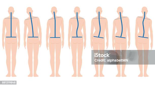 Forma Della Schiena Umana - Immagini vettoriali stock e altre immagini di Il corpo umano - Il corpo umano, Posizione scorretta, Spina dorsale - Parte del corpo