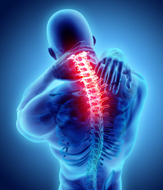 istock Neck painful - cervical spine skeleton x-ray, 3D illustration. 881474966