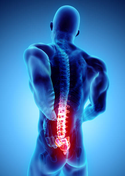 istock 3D Illustration of sacral spine painful. 881478102