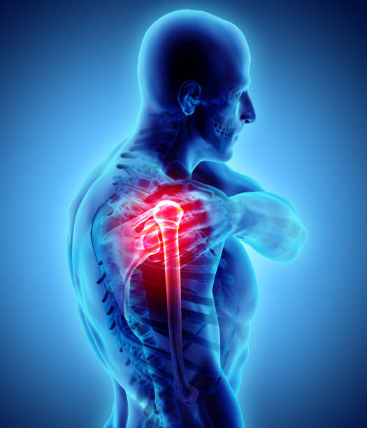 istock Shoulder painful skeleton x-ray, 3D illustration. 881478228