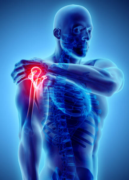 istock Shoulder painful skeleton x-ray, 3D illustration. 881478230