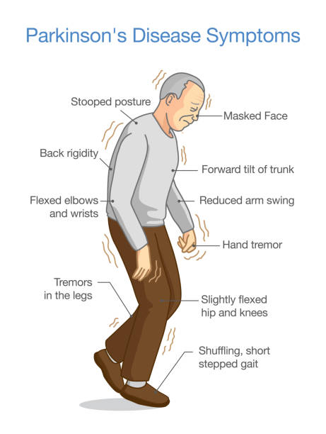 Parkinson's Disease Symptoms. Parkinson's Disease Symptoms. Illustration about health problem of elderly people. walk slowly stock illustrations