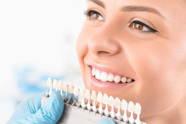 hermosa sonrisa y dientes blancos de una mujer joven. - dental implant dental hygiene dentures prosthetic equipment fotografías e imágenes de stock