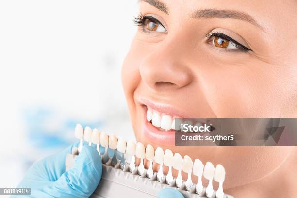 Beautiful Smile And White Teeth Of A Young Woman Stock Photo - Download Image Now - Tooth Whitening, Teeth, White Color