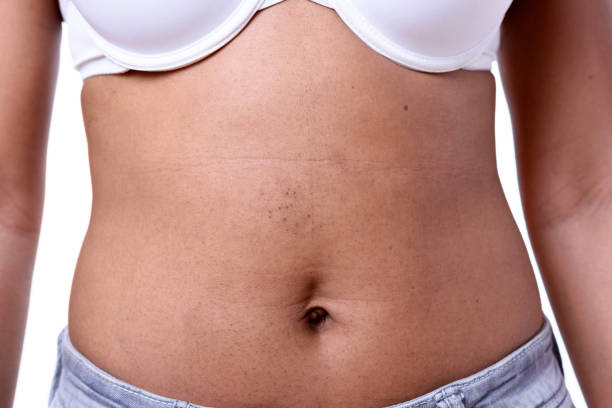 istock Close up view of female belly 882128114