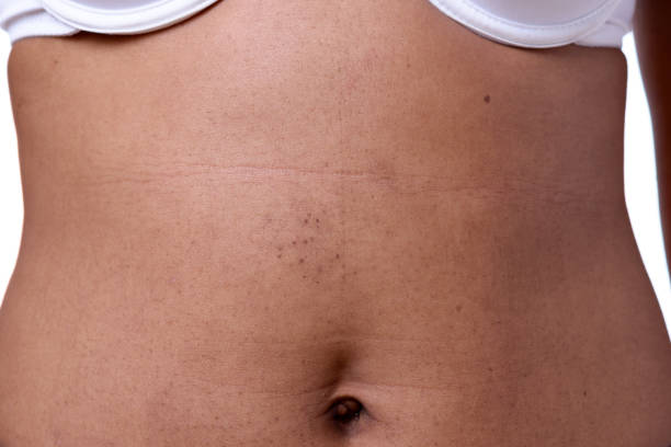 istock Close up view of female belly 882131662