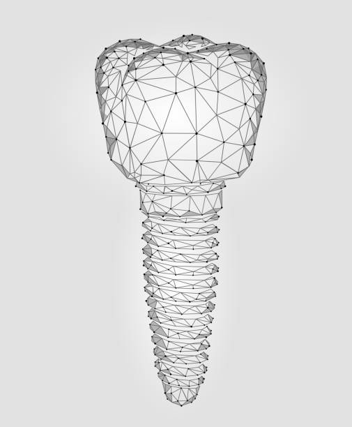 backenzahn zahnimplantat 3d low-poly - human teeth dental equipment three dimensional shape technology stock-grafiken, -clipart, -cartoons und -symbole