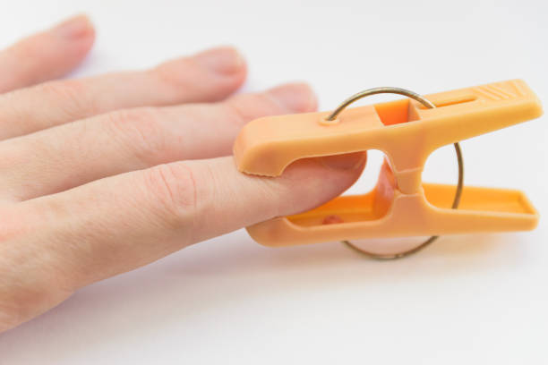 istock Clothespin pinch a hand. 882959792