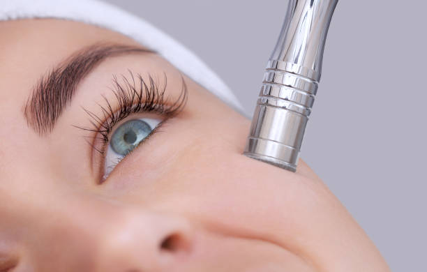 il cosmetologo effettua la procedura microdermabrasion della pelle del viso - microdermabrasion foto e immagini stock