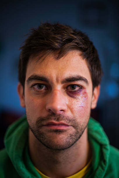hombre con ojo negro retrato - posing looking at camera combative sport boxing fotografías e imágenes de stock