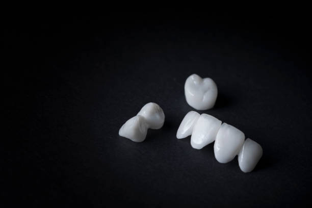 istock zirconia dentures on dark background - Ceramic dentures - 884391568