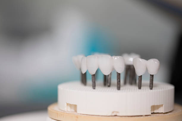 istock zirconia dentures on it's last steps - Ceramic dentures - 884391964