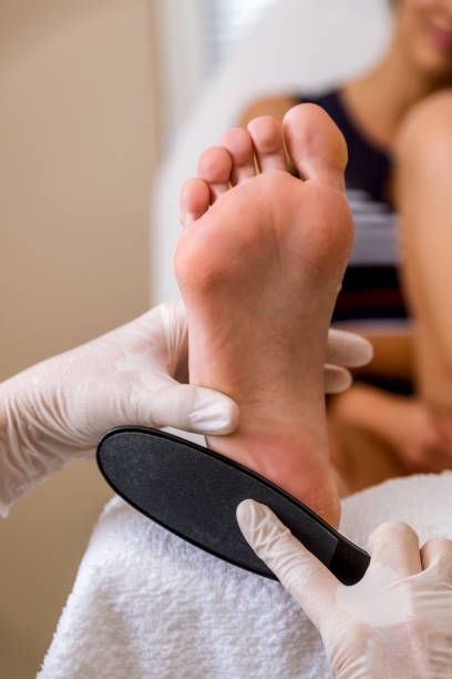 Foot treatment. stock photo