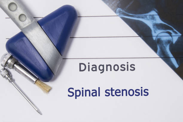 diagnóstico neurológico de estenose espinal. diretório de neurologista, onde é impresso diagnóstico estenose espinal, encontra-se no local de trabalho com imagens de ressonância magnética e ferramentas de diagnóstico neurológicas close-up - photo album book spine photograph photography - fotografias e filmes do acervo