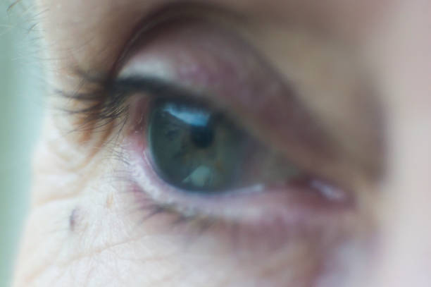 istock Eye  blue, woman mature 885712240